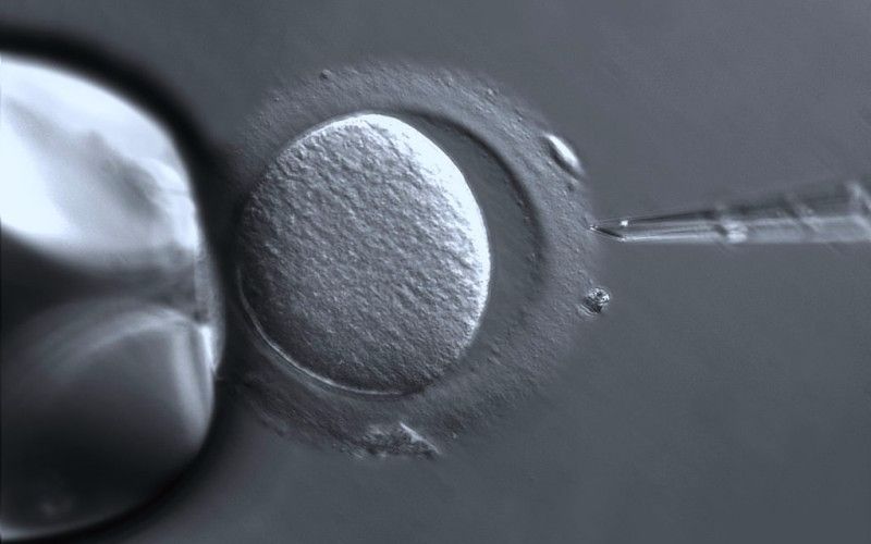 in vitro fertilization 