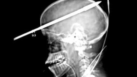 teen shot with spear in head